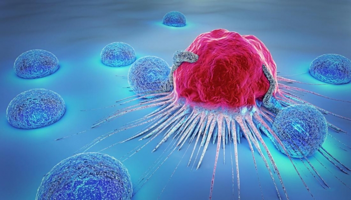 Research on Cancer Shows Cancer is Rising in Rich Countries